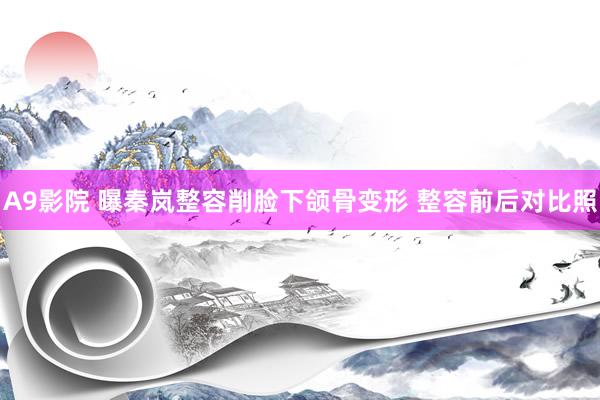 A9影院 曝秦岚整容削脸下颌骨变形 整容前后对比照